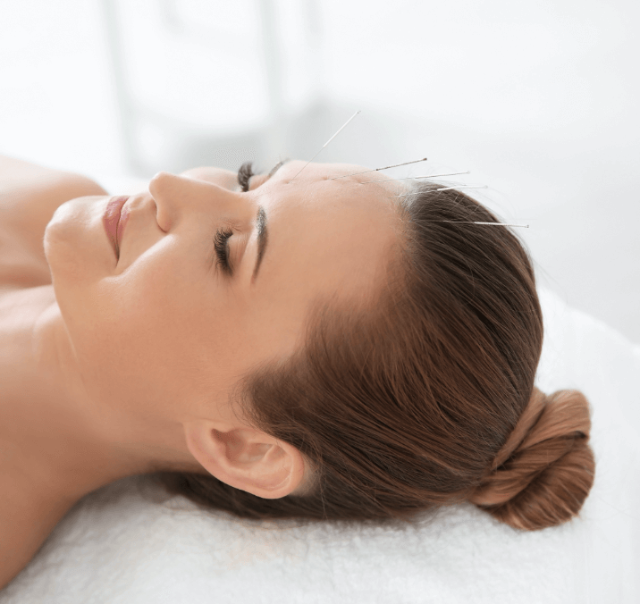 Acunpucture - Total Vitality Center Burnaby BC - Top User Reviews On Google Local Service Health and Wellness Centre