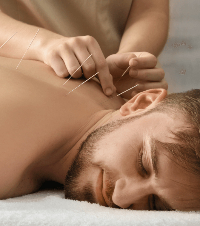 Acupuncture Services in Burnaby BC and Vancouver- Top Reviewed Total Vitality Center Wins Best Health, Wellness and Therapy Clinic Services Mind and Body